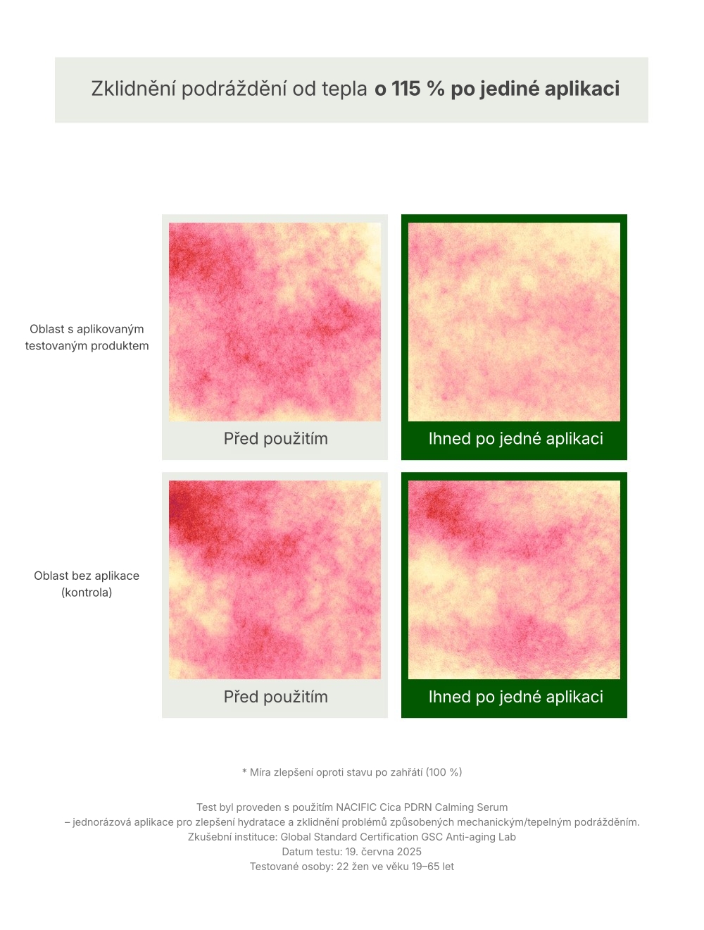 1.6. NACIFIC Detailed Page Cica PDRN Calming Serum